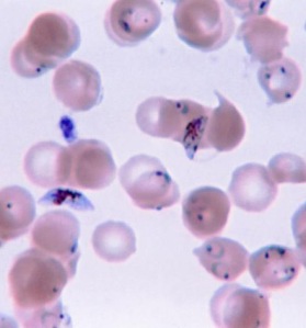 Plasmodium falciparum and red blood cells. 