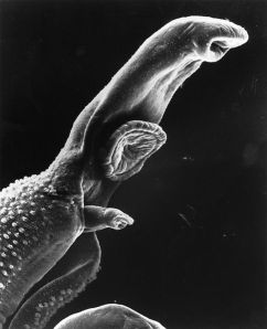 A scanning electron microscope image of a Schistosome parasite